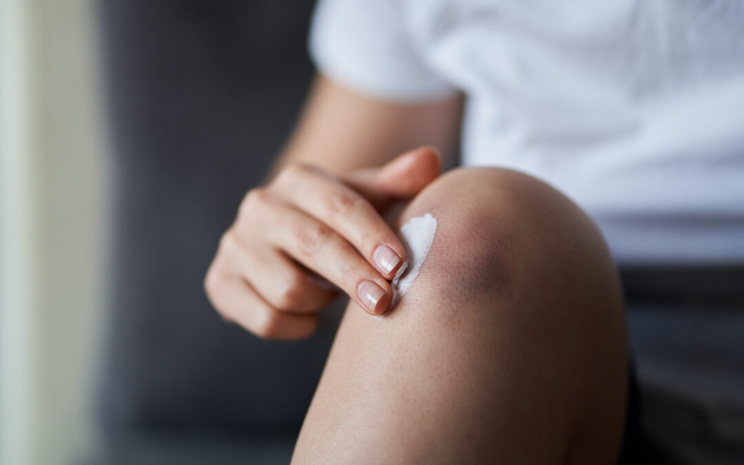 Do Any Topical Pain Meds Actually Provide Joint Pain Relief?